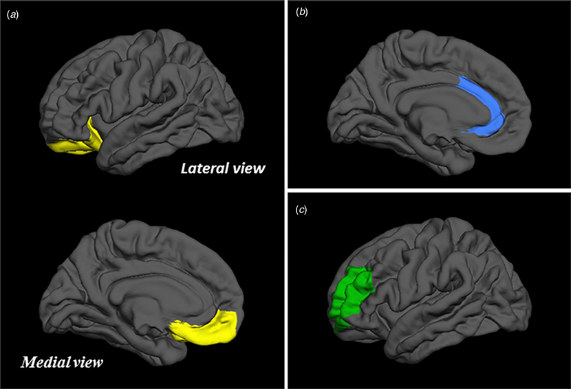 Afbeelding uit de publicatie die een visualisatie van de hersenen weergeeft